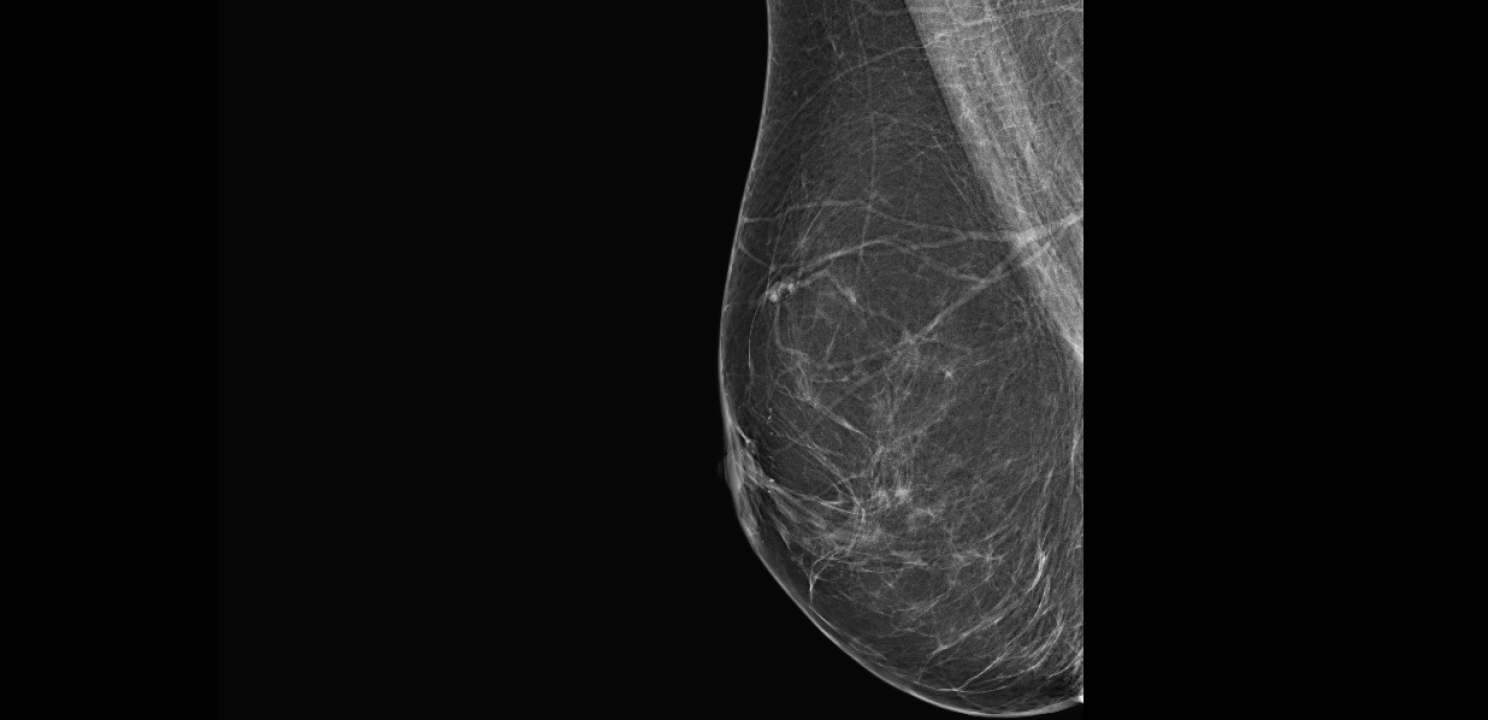 Zakažite preventivni pregled dojke u poliklinici Affidea Vita! 