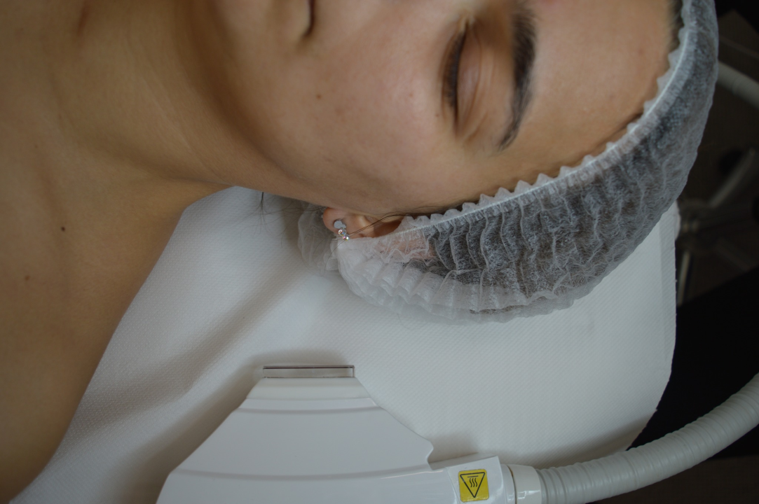 Riješite se neželjenih dlačica prije ljeta u Be You salonu!