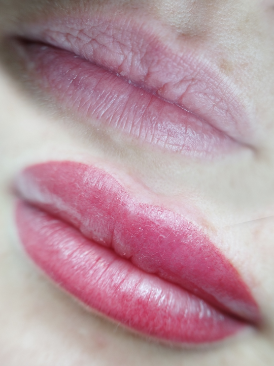 Riješite se uraslih noktiju uz medicinsku pedikuru!