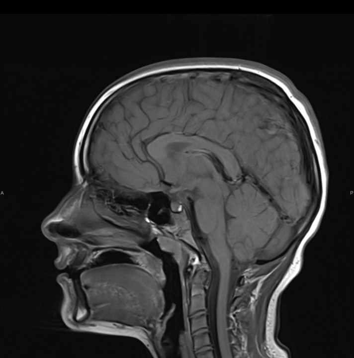 Tijekom Tjedna mozga Poliklinika Affidea Vita daje 20 posto popusta na magnetsku rezonancu!
