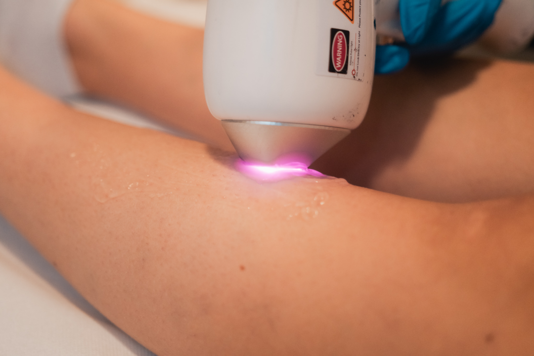 Beauty bar Tamara časti vas vrhunskim popustima na brojne tretmane za uljepšavanje i njegu tijela!