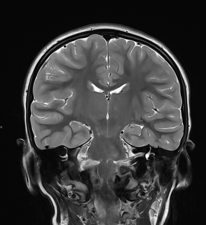 FOTO Naručite se na rendgen, ultrazvuk, CT ili MR u Poliklinici Affidea Vita!