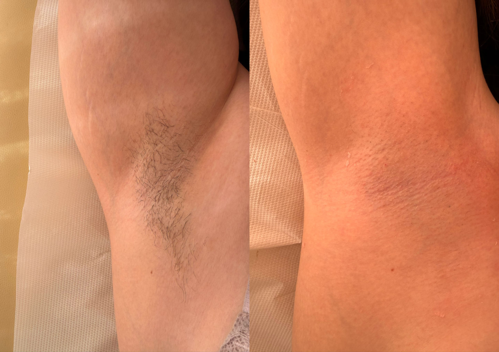 FOTO Uz ekskluzivne Aura Harmony pakete dovedite svoje tijelo do savršene ljetne forme!