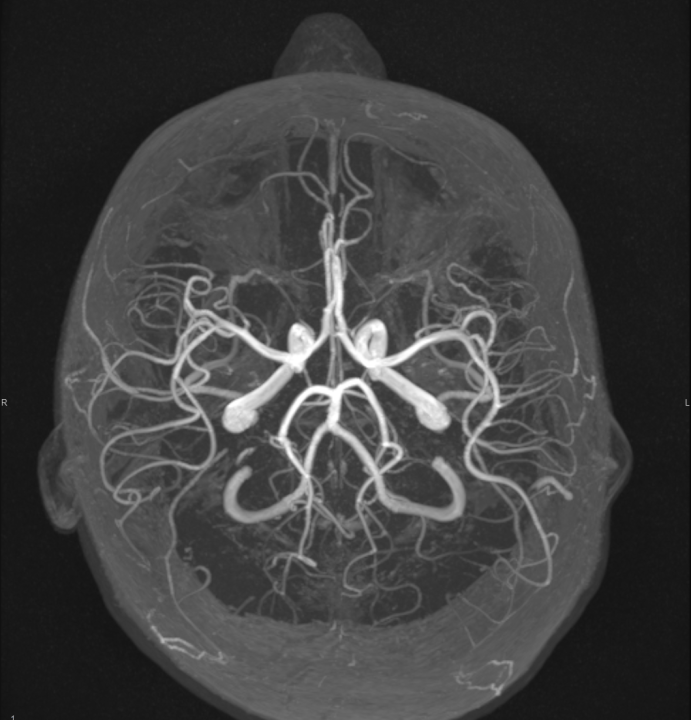 Tijekom Tjedna mozga Poliklinika Affidea Vita daje 20 posto popusta na magnetsku rezonancu!