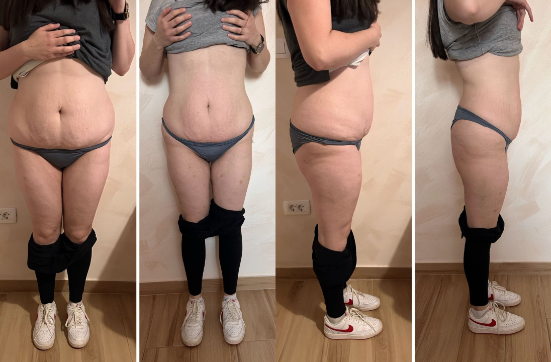 FOTO Tražite motivaciju nakon blagdana? Beauty Clinic by Tamara donosi izazov uz koji se vraćate u formu!